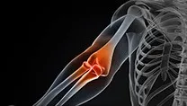 Shoulder & Elbow Arthroscopic (keyhole)